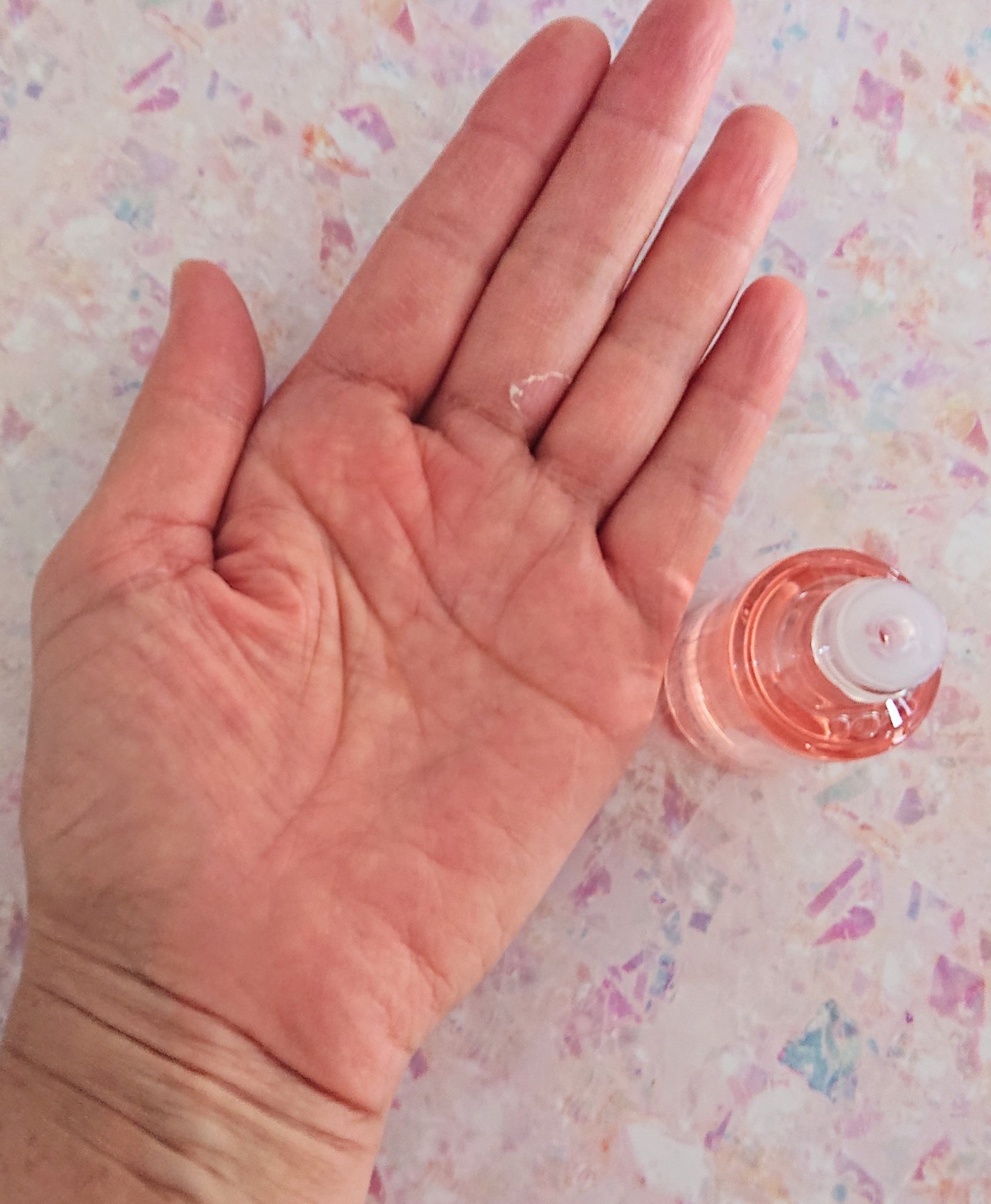 バイオイル/バイオイル/フェイスオイルを使ったクチコミ（3枚目）