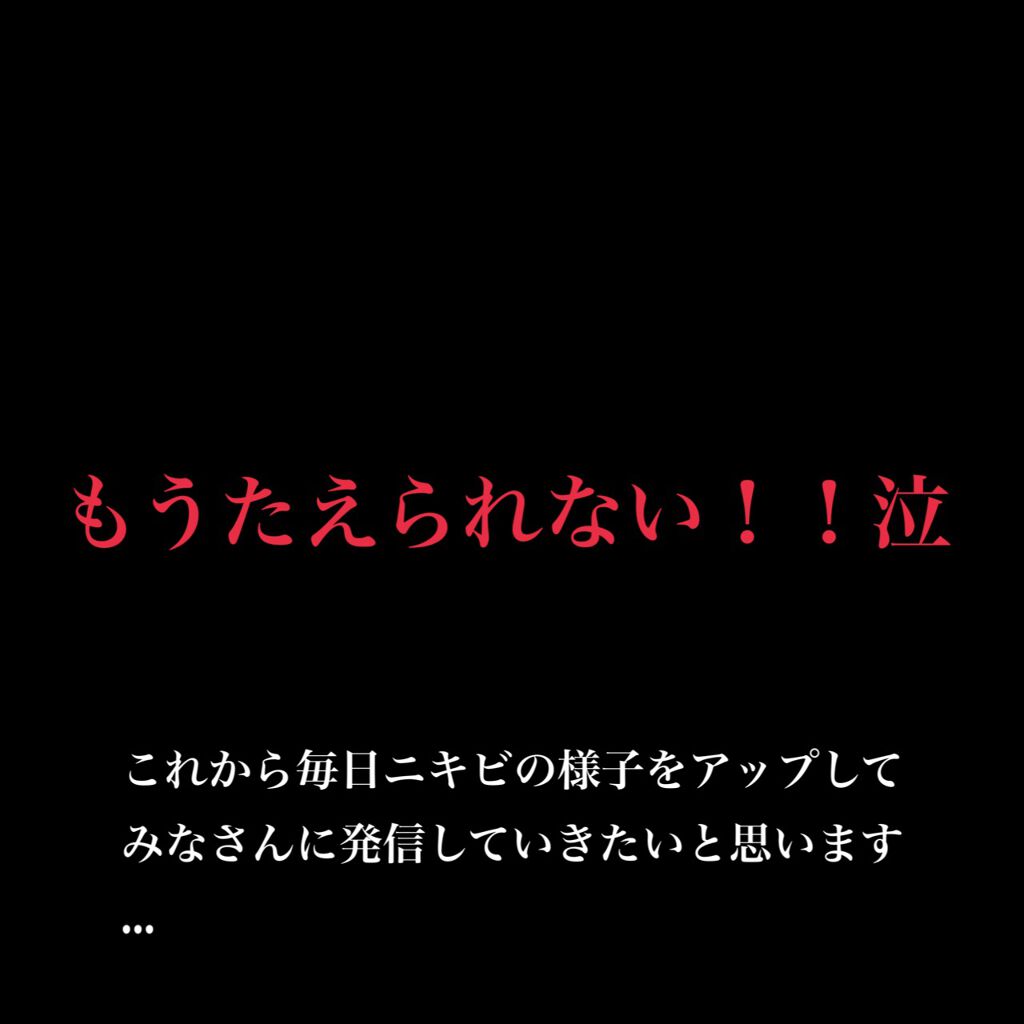 ウオーター/アベンヌ/ミスト状化粧水を使ったクチコミ（1枚目）