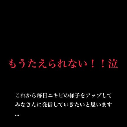 ニキビあとケアジェル/アットノン/その他スキンケアを使ったクチコミ(1枚目)