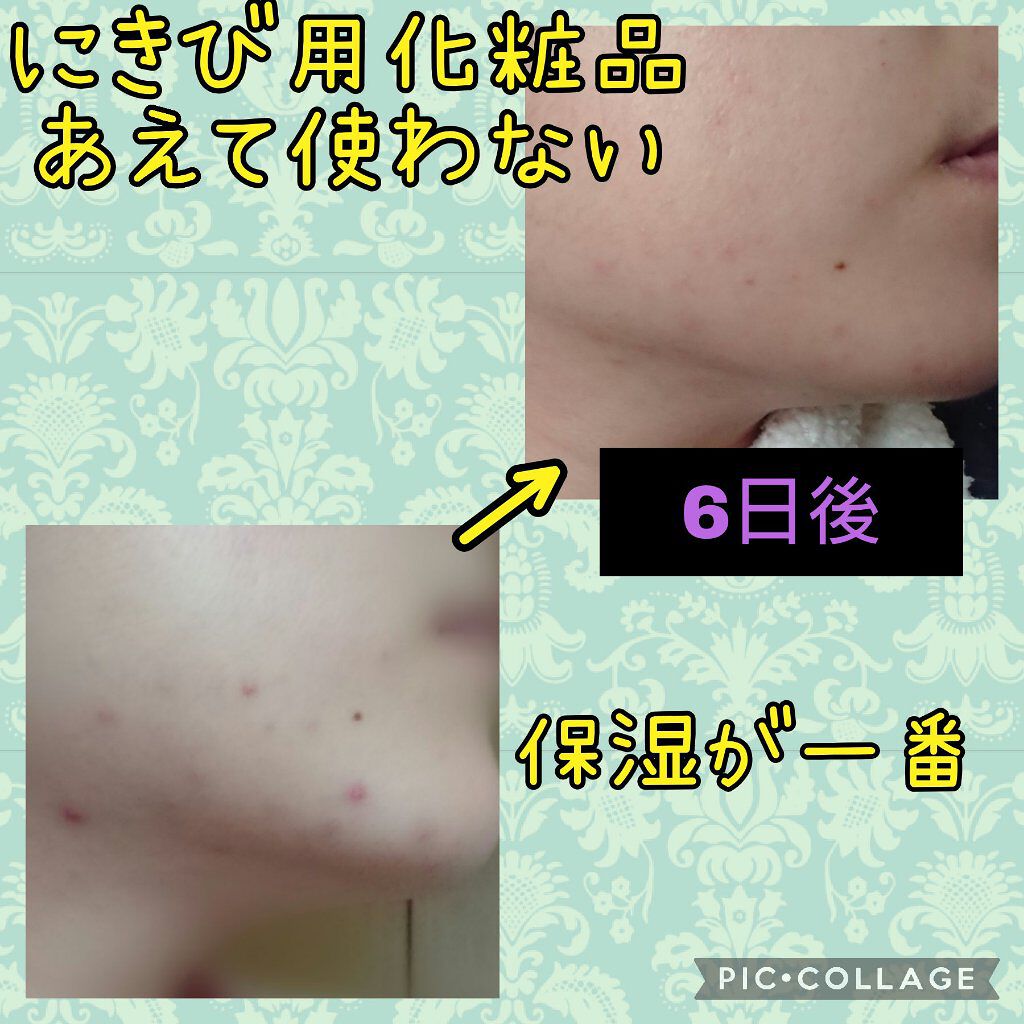 潤浸保湿 化粧水 III とてもしっとり/キュレル/化粧水を使ったクチコミ（1枚目）