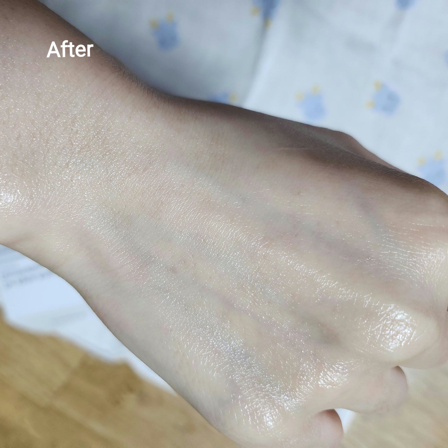 アビブ グルタチオンソームダークスポットセラムビタドロップ/Abib /美容液を使ったクチコミ(4枚目)