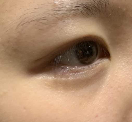 アイビューティー フィクサー WP/アストレア ヴィルゴ/二重まぶた用アイテムを使ったクチコミ（2枚目）