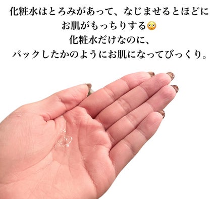 モイストケア ローション MB/d プログラム/化粧水を使ったクチコミ(3枚目)