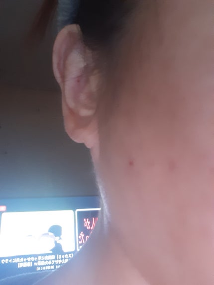 リードルショット リフティングセラム/VT/美容液を使ったクチコミ(3枚目)