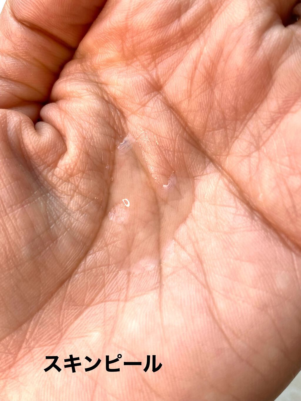 タカミスキンピール/タカミ/ブースター・導入液を使ったクチコミ(2枚目)