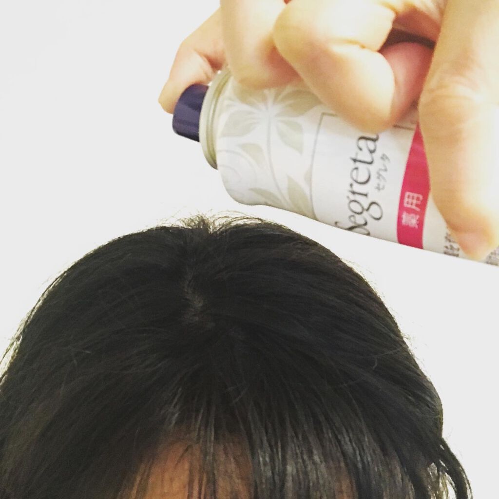 セグレタ髪を育むスプレー/セグレタ/頭皮ローションを使ったクチコミ(3枚目)
