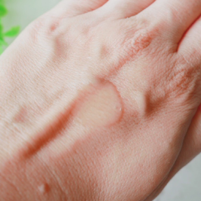 オバジX フレームリフトローション/オバジ/化粧水を使ったクチコミ（3枚目）