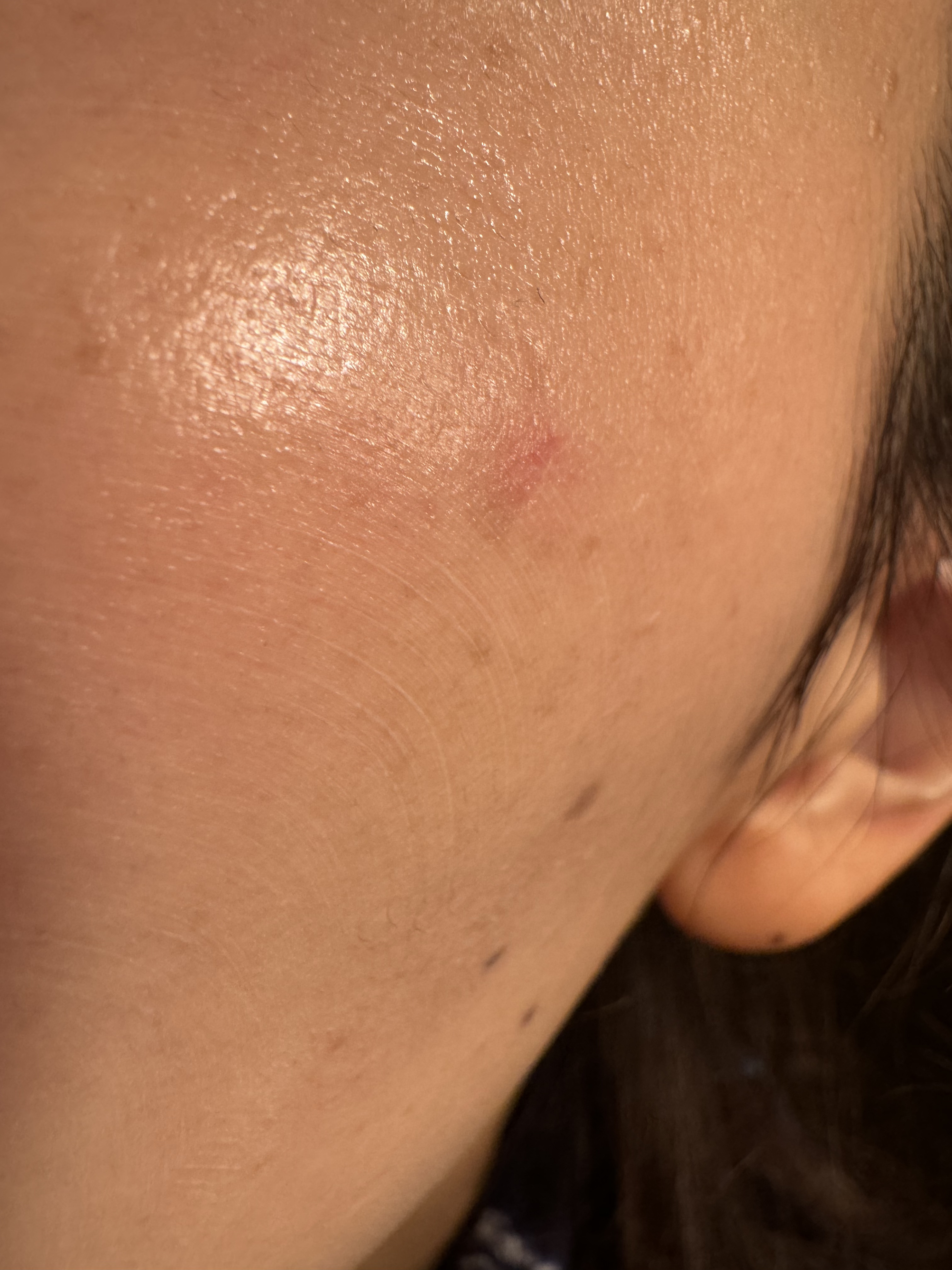 ロングラスティングチップコンシーラー/LUNA/リキッドコンシーラーを使ったクチコミ（2枚目）