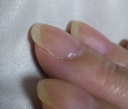 ボリュームジェルトップコート/ネイルネイル/ネイルトップコートを使ったクチコミ(1枚目)