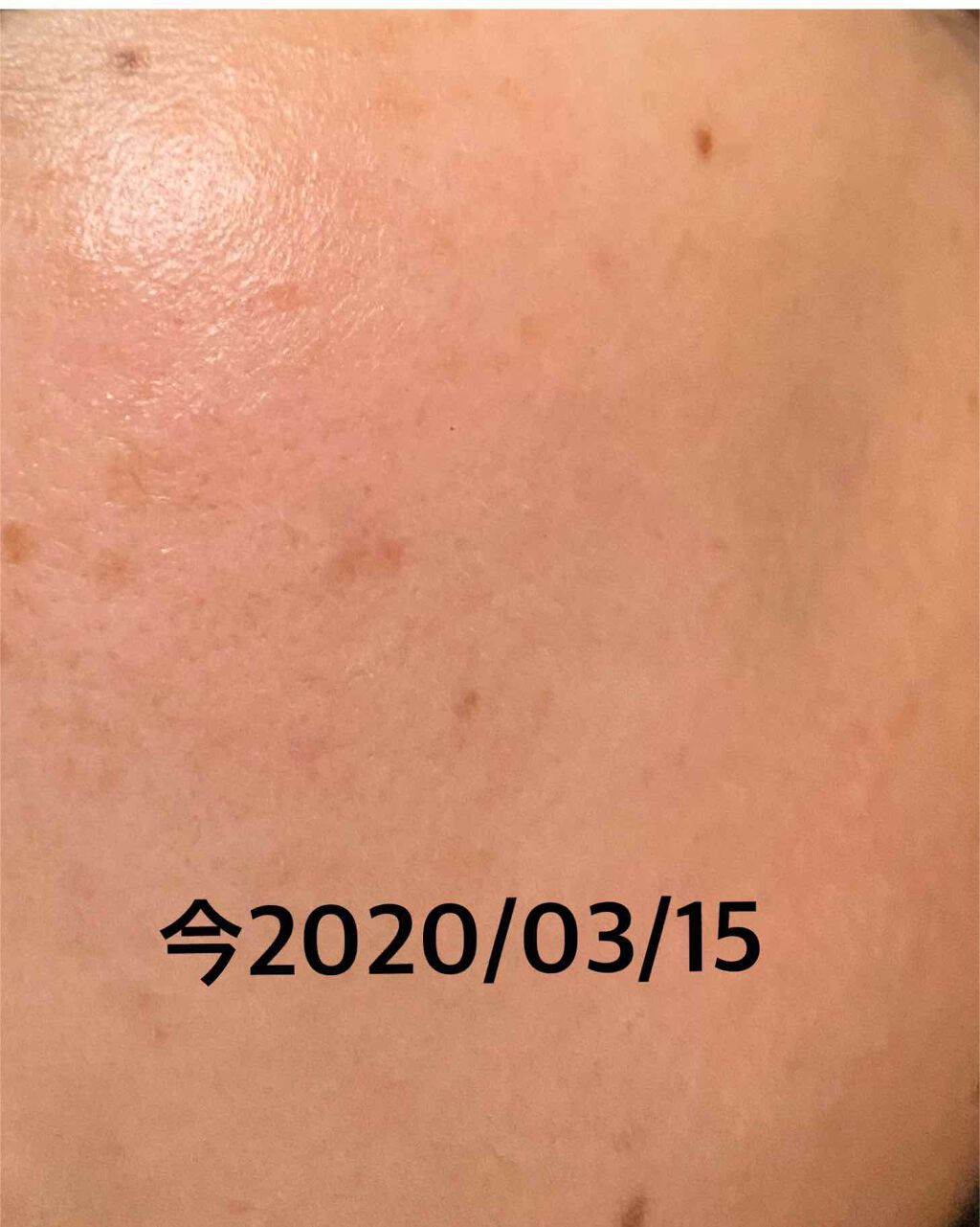 ハトムギ化粧水(ナチュリエ スキンコンディショナー R )/ナチュリエ/化粧水を使ったクチコミ(2枚目)