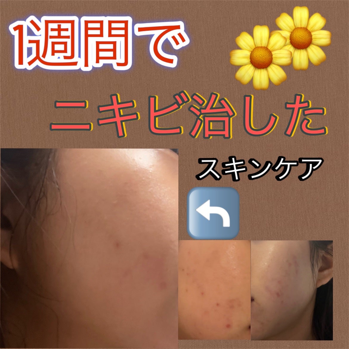 CICA デイリースージングマスク/VT/シートマスク・パックを使ったクチコミ(1枚目)