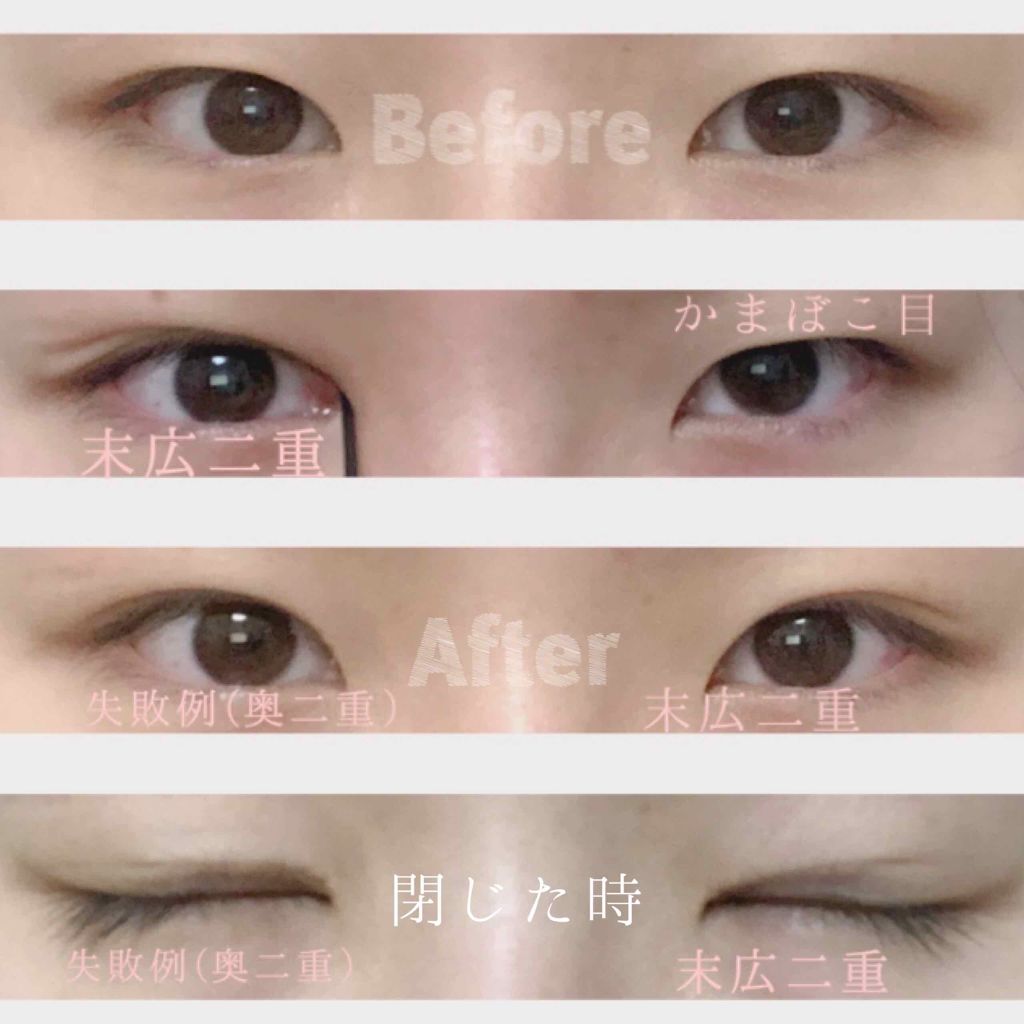 ダブルアイリキッド/Automatic Beauty/二重まぶた用アイテムを使ったクチコミ(4枚目)