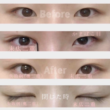 ダブルアイリキッド/Automatic Beauty/二重まぶた用アイテムを使ったクチコミ(4枚目)