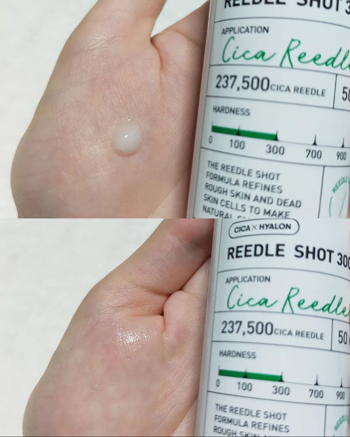 リードルショット100/VT/美容液を使ったクチコミ（3枚目）