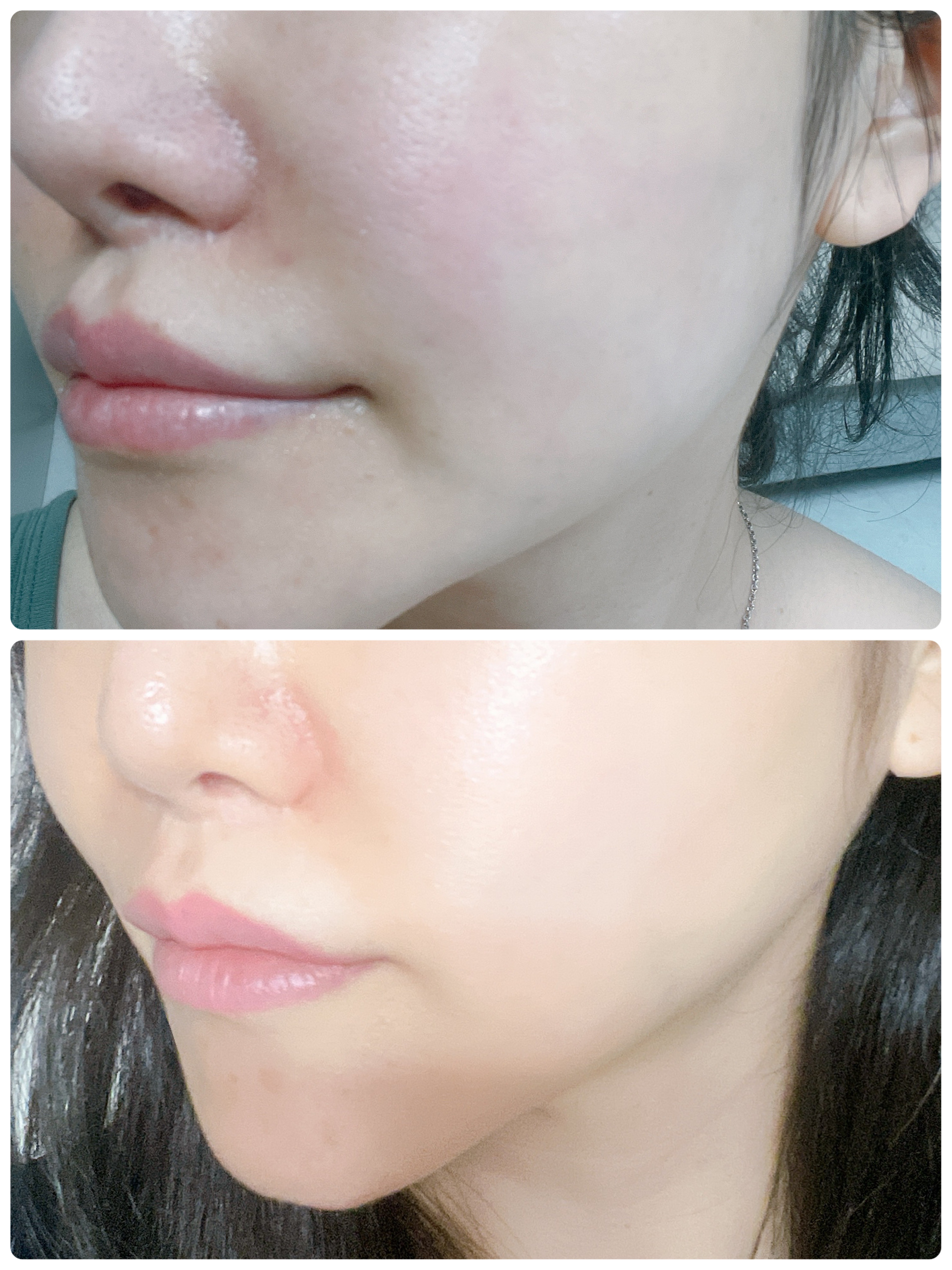 グルタ ビタミンC トーニング アンプル/IOPE/美容液を使ったクチコミ（2枚目）