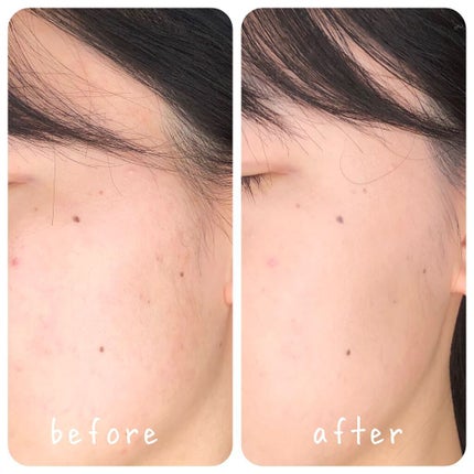 レイヤード カバーファンデーション/NAMING./リキッドファンデーションを使ったクチコミ(2枚目)