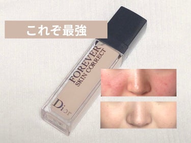 【旧】ディオールスキン フォーエヴァー スキン コレクト コンシーラー/Dior/コンシーラーを使ったクチコミ（1枚目）