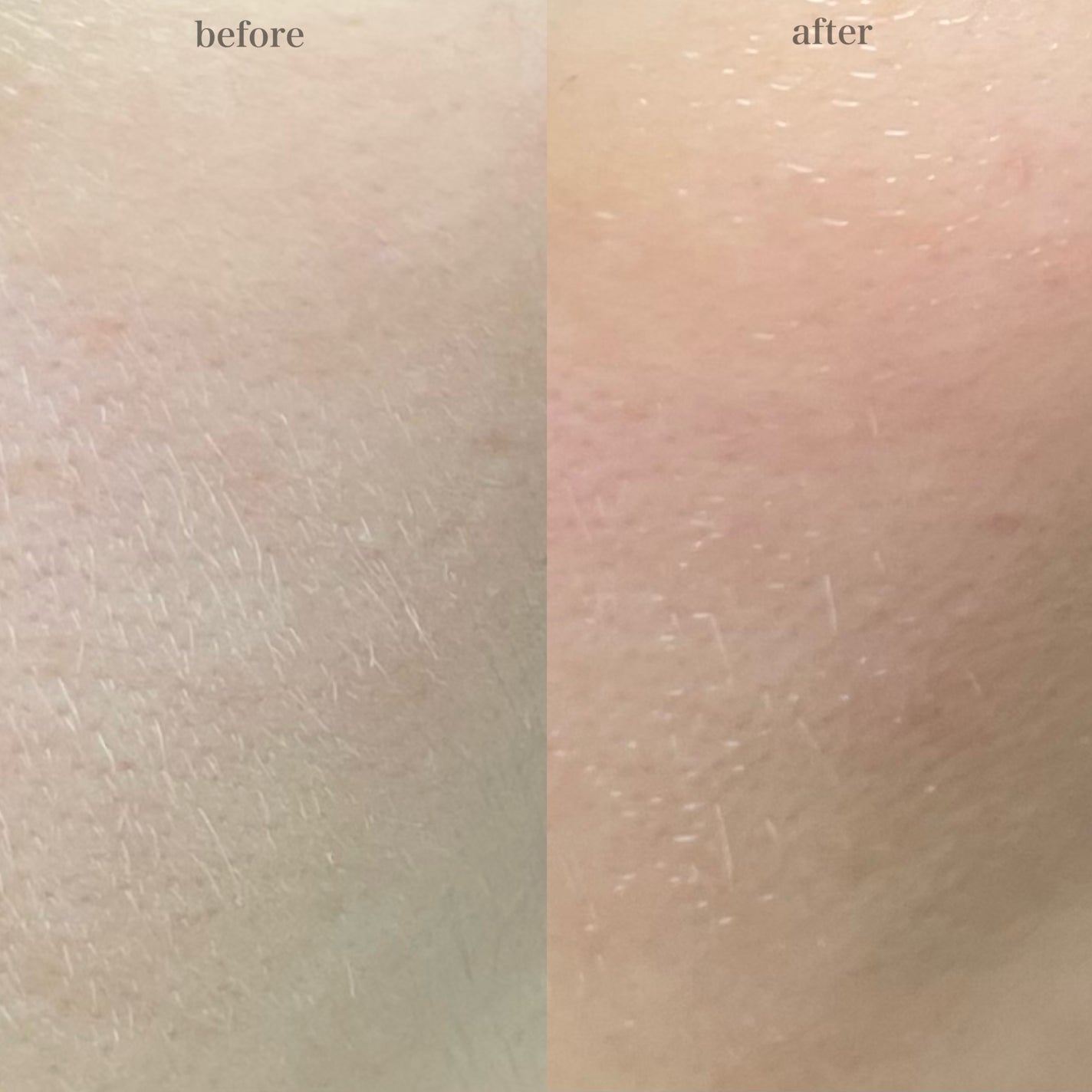 レチノール スーパーバウンス セラム/IOPE/美容液を使ったクチコミ(3枚目)