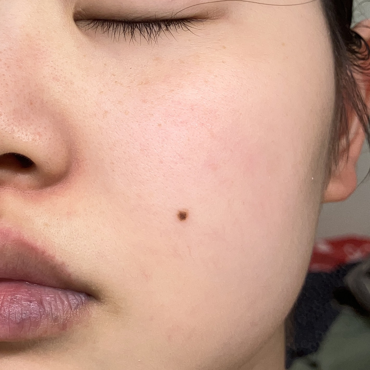 TXトーニングエッセンス2000/VT/美容液を使ったクチコミ（2枚目）