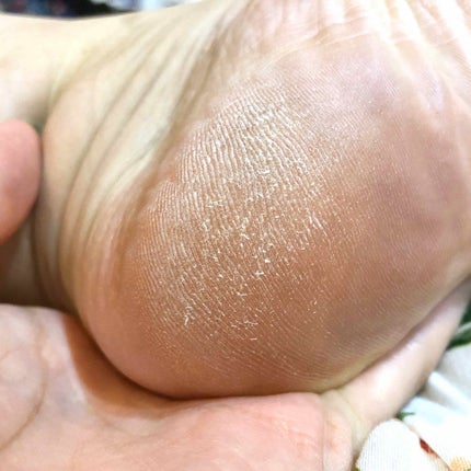 ニベアクリーム/ニベア/ボディクリームを使ったクチコミ(2枚目)