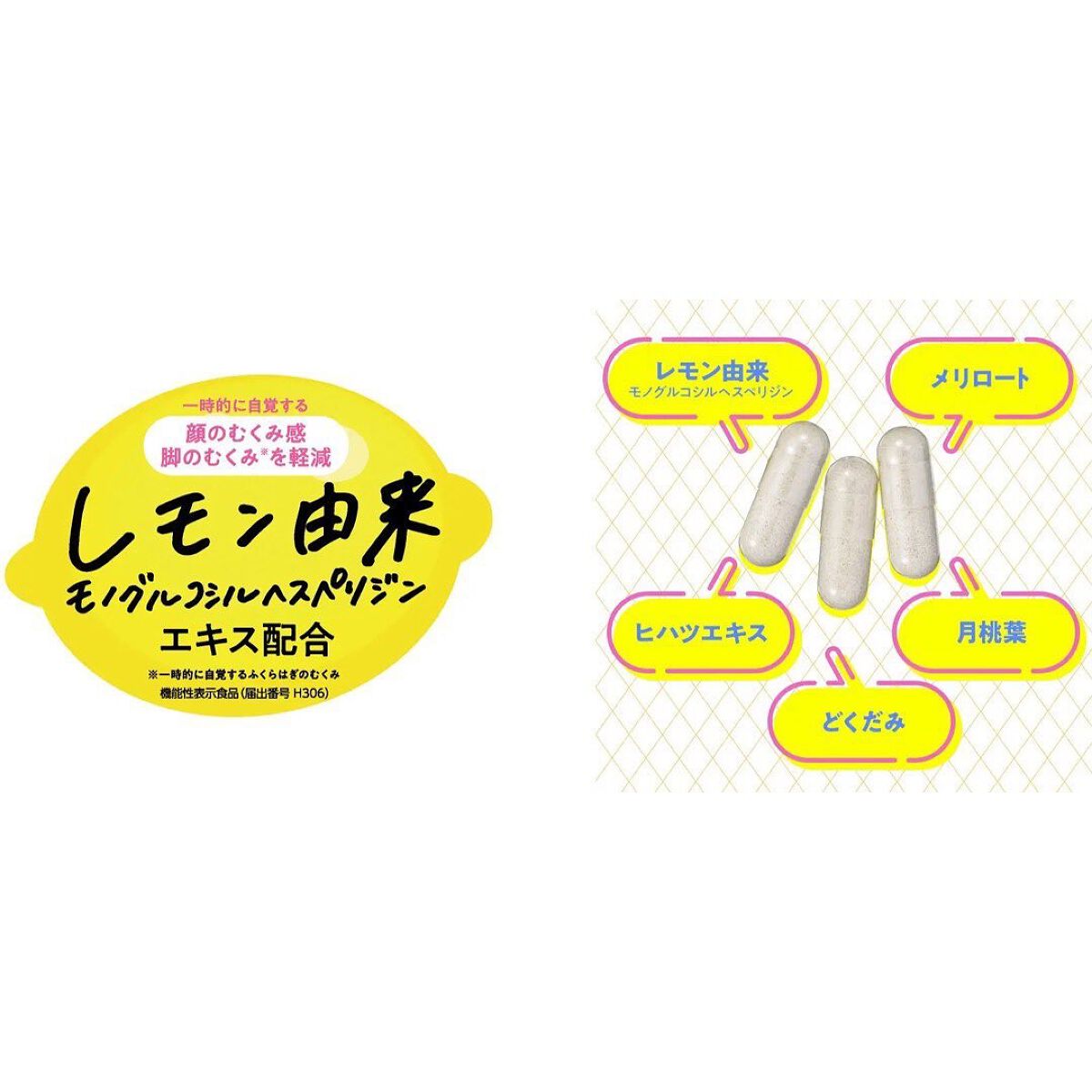 むくみぱっくん/スベルティ/健康サプリメントを使ったクチコミ（3枚目）