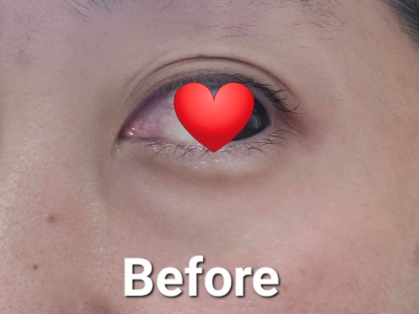 アイレノール クマクリーム/IRENOL/アイケア・アイクリームを使ったクチコミ(3枚目)