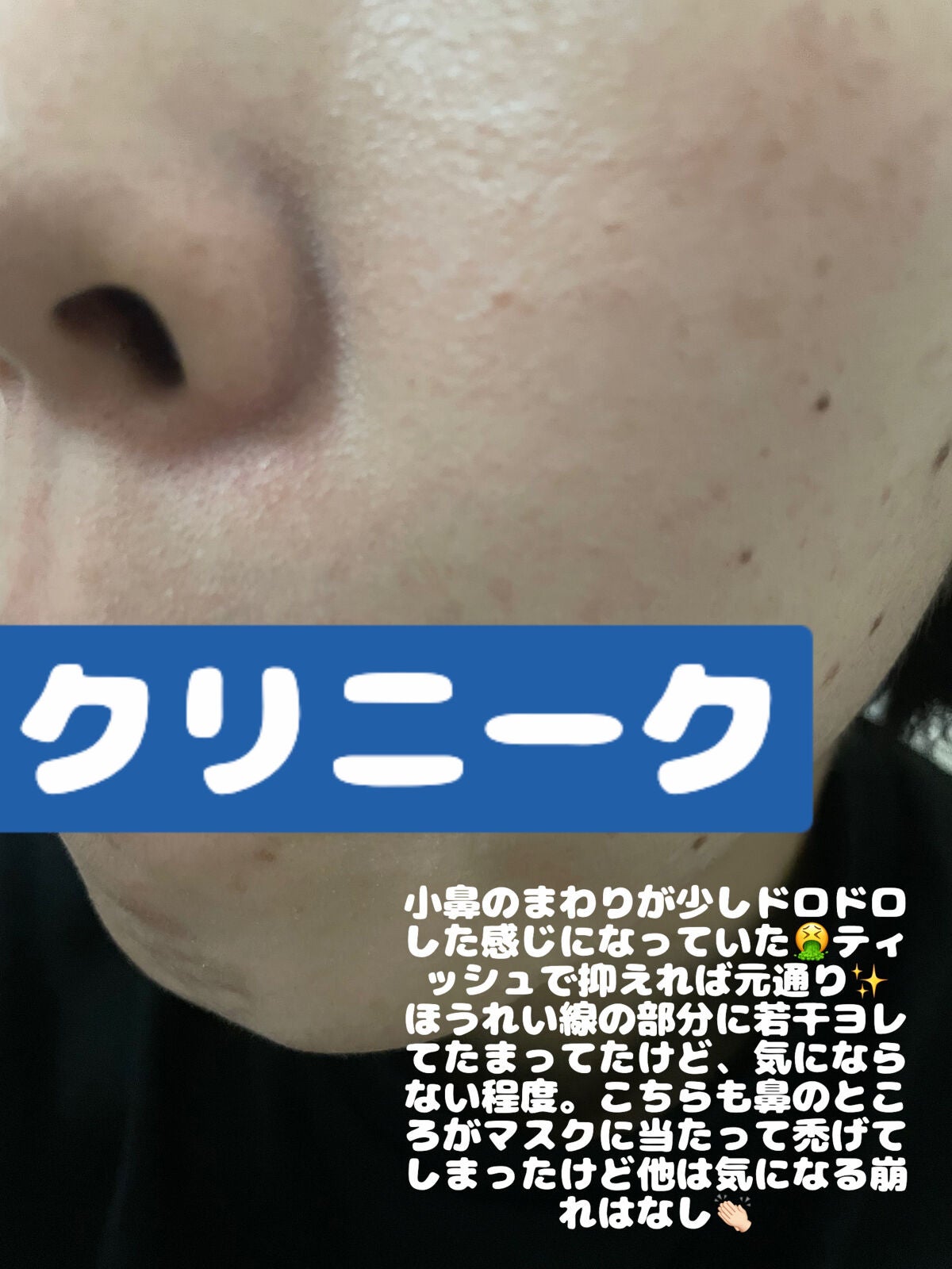 ライトリフレクティングセッティングパウダー プレスト N/NARS/プレストパウダーを使ったクチコミ(6枚目)