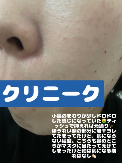 ライトリフレクティングセッティングパウダー プレスト N/NARS/プレストパウダーを使ったクチコミ(6枚目)