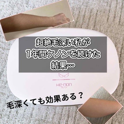 光美容器KE-NON(ケノン)/エムテック/家庭用脱毛器を使ったクチコミ(1枚目)
