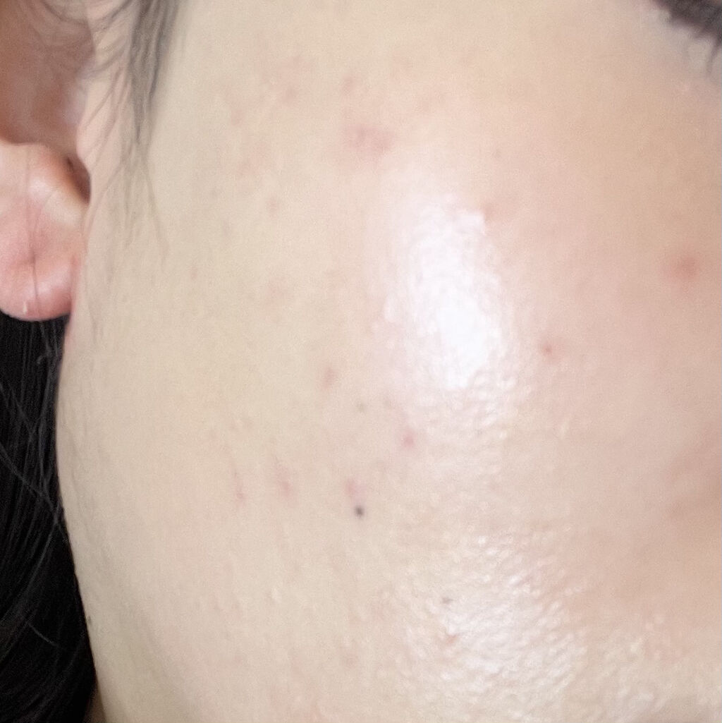 タンイドル ウルトラ ウェア リキッド/LANCOME/リキッドファンデーションを使ったクチコミ（2枚目）