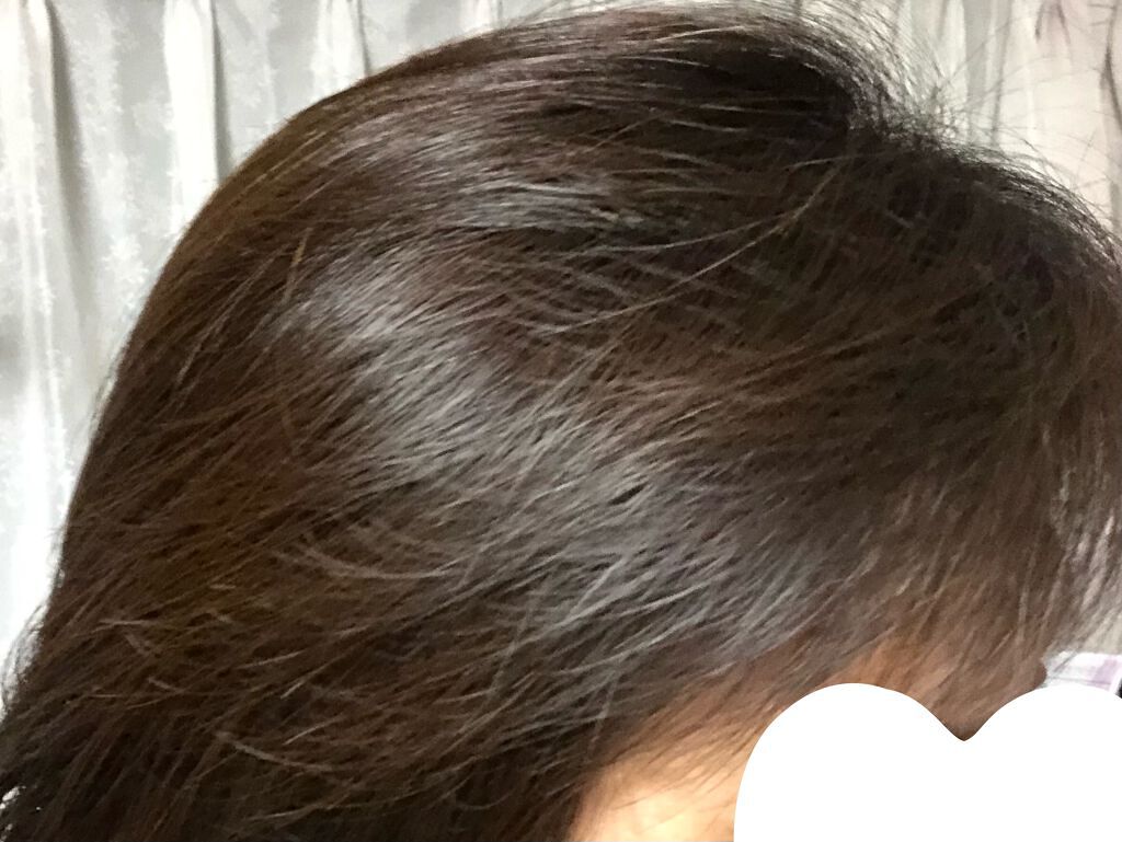 リンシングビネガー シルキーシャイン さらキララズベリー/イヴ・ロシェ/洗い流すヘアトリートメントを使ったクチコミ(3枚目)