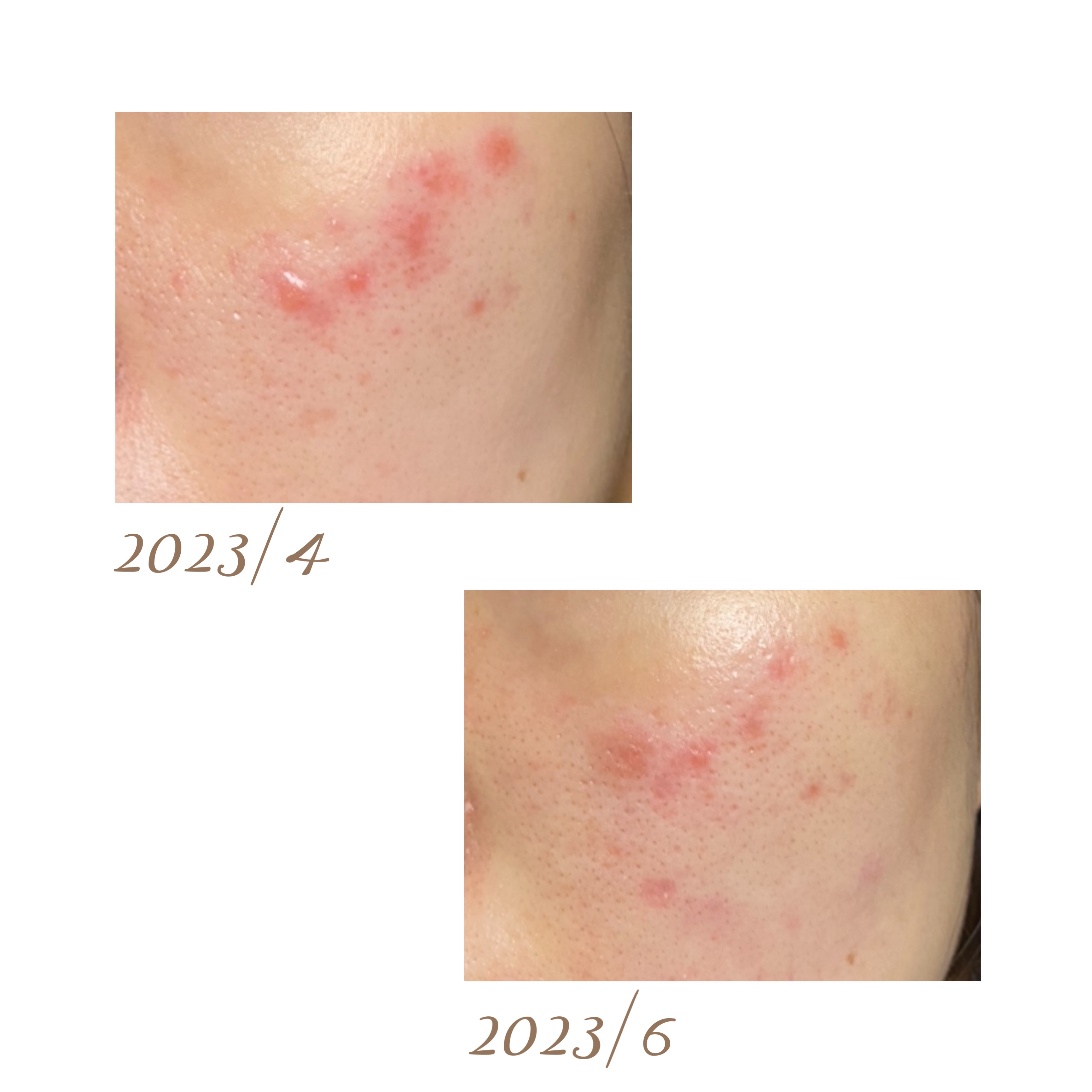 レチビタエッセンスマスク/ピュレア/シートマスク・パックを使ったクチコミ（2枚目）