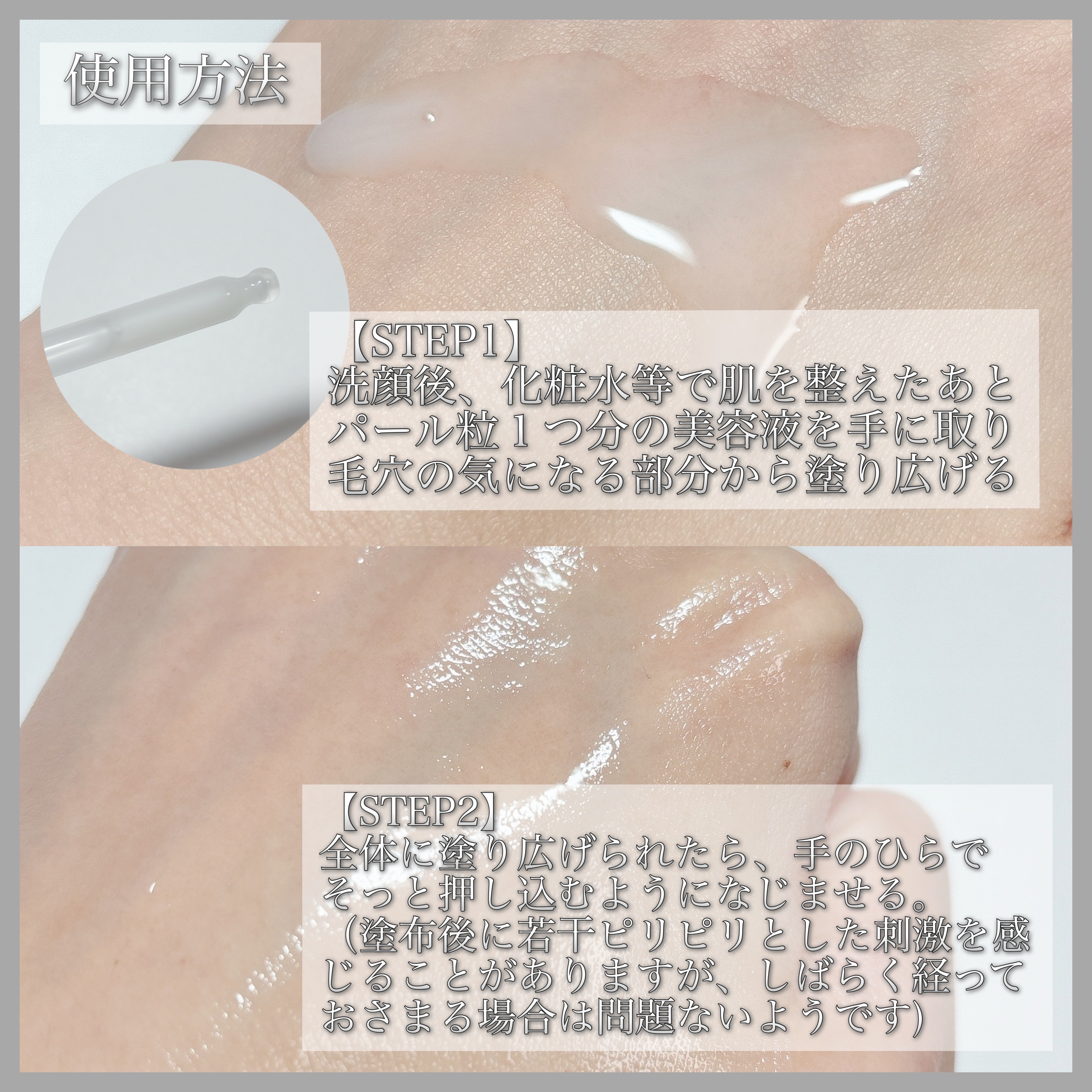 ダーマセラム アゼライン酸5%/SHIMBI METHOD/美容液を使ったクチコミ（3枚目）