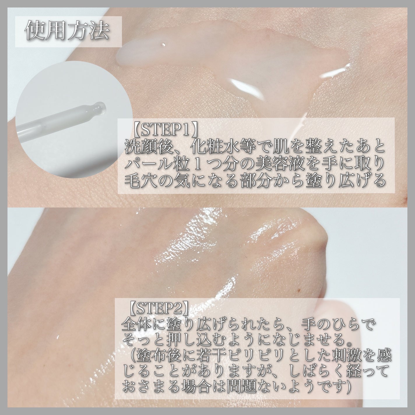 ダーマセラム アゼライン酸5%/SHIMBI METHOD/美容液を使ったクチコミ(3枚目)