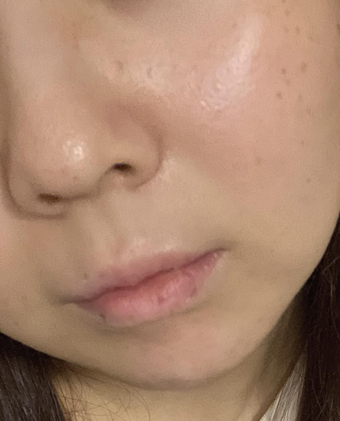 オードムーゲ 薬用ローション（ふきとり化粧水）/オードムーゲ/拭き取り化粧水を使ったクチコミ（3枚目）