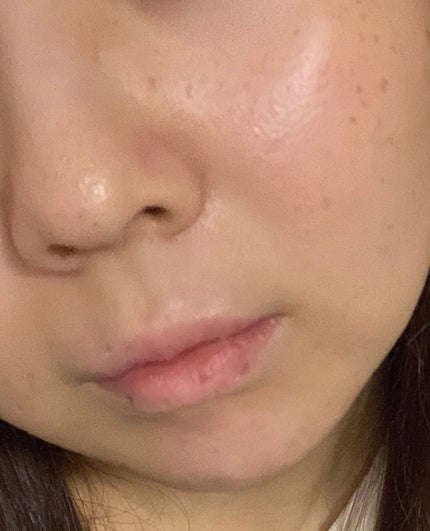 オードムーゲ 薬用ローション(ふきとり化粧水)/オードムーゲ/拭き取り化粧水を使ったクチコミ(3枚目)