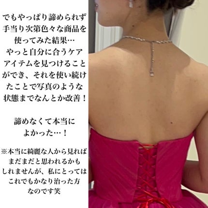 ニキビを防ぐ薬用石鹸 ForBack/ペリカン石鹸/ボディ石鹸を使ったクチコミ(3枚目)
