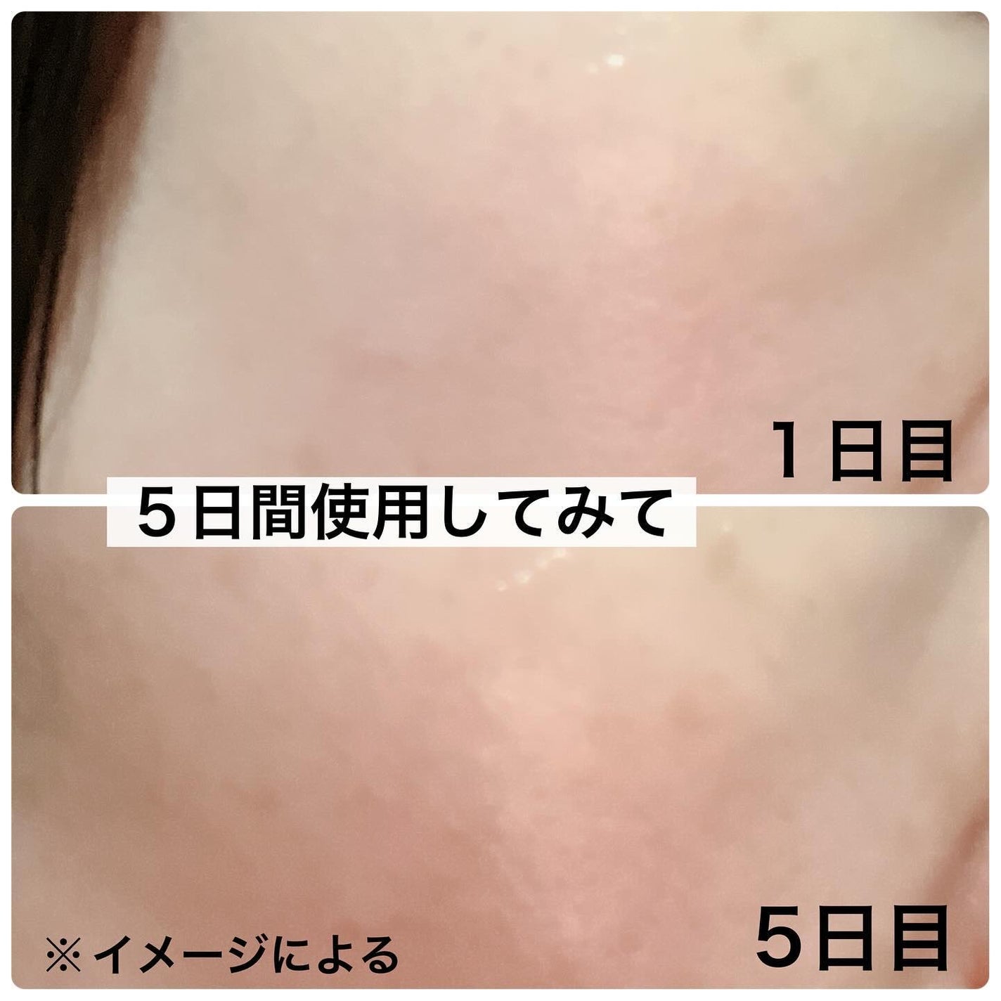 ピーディーアールエヌエッセンス PDRN 100/VT/美容液を使ったクチコミ(9枚目)