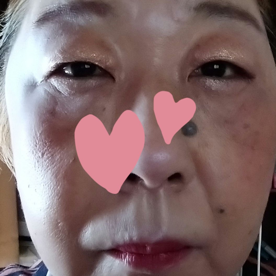 フィットミー リキッド ファンデーション DN/MAYBELLINE NEW YORK/リキッドファンデーションを使ったクチコミ（3枚目）