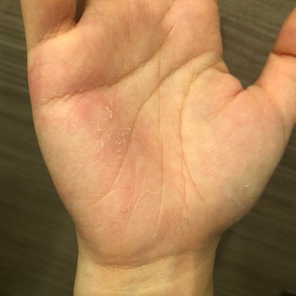 レチノール シカ リペア セラム/innisfree/美容液を使ったクチコミ(2枚目)