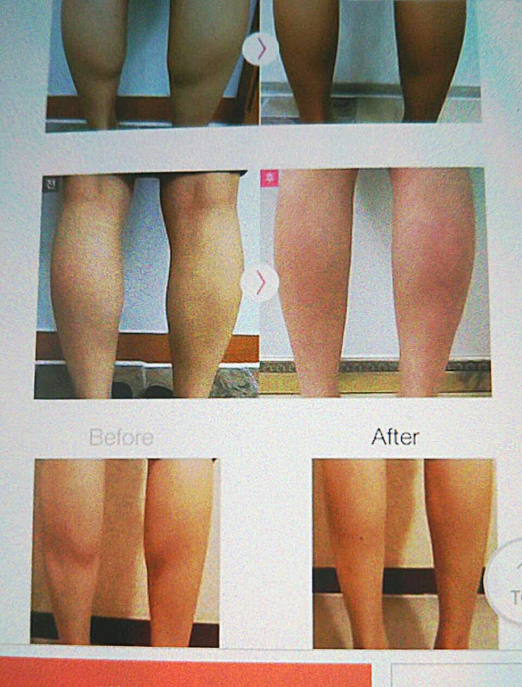 指圧スリッパ/ボディグッズを使ったクチコミ（3枚目）