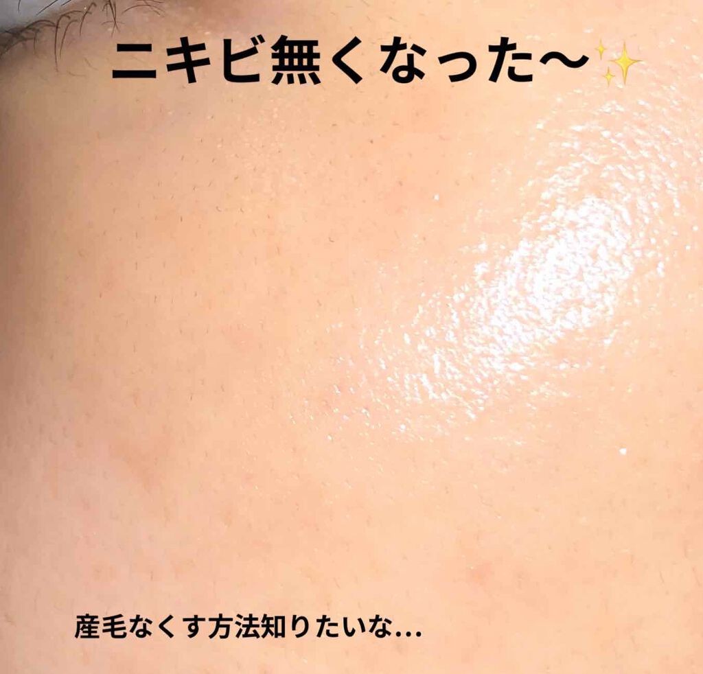 ハトムギ化粧水(ナチュリエ スキンコンディショナー R )/ナチュリエ/化粧水を使ったクチコミ(1枚目)