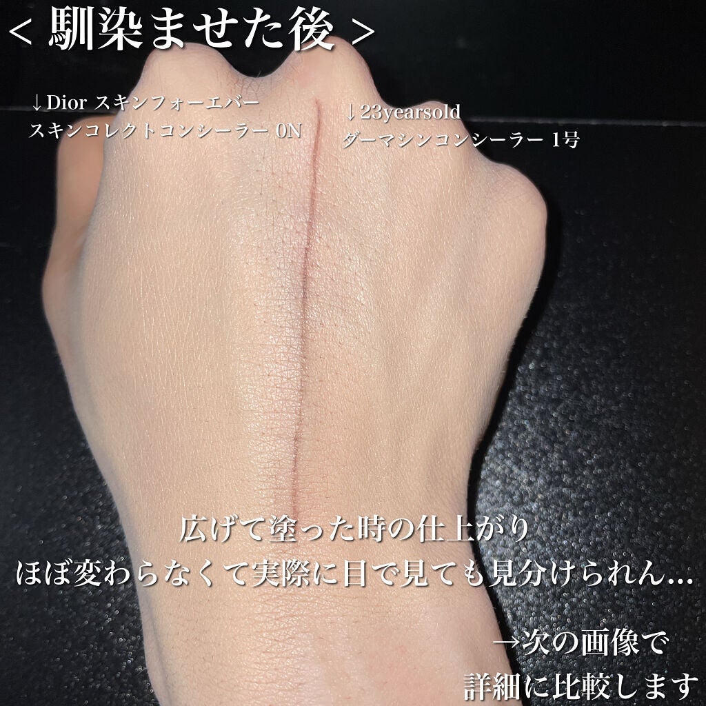 【旧】ディオールスキン フォーエヴァー スキン コレクト コンシーラー/Dior/リキッドコンシーラーを使ったクチコミ(5枚目)