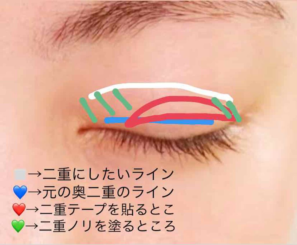 アイトーク/アイトーク/二重まぶた用アイテムを使ったクチコミ（2枚目）