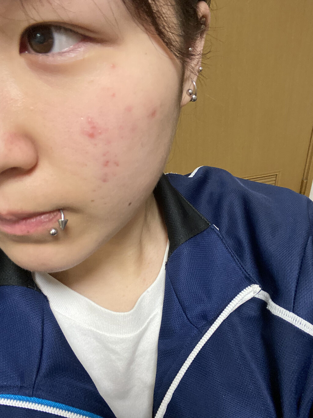 ウルミニスタ アクア ローション/DHC/化粧水を使ったクチコミ（2枚目）