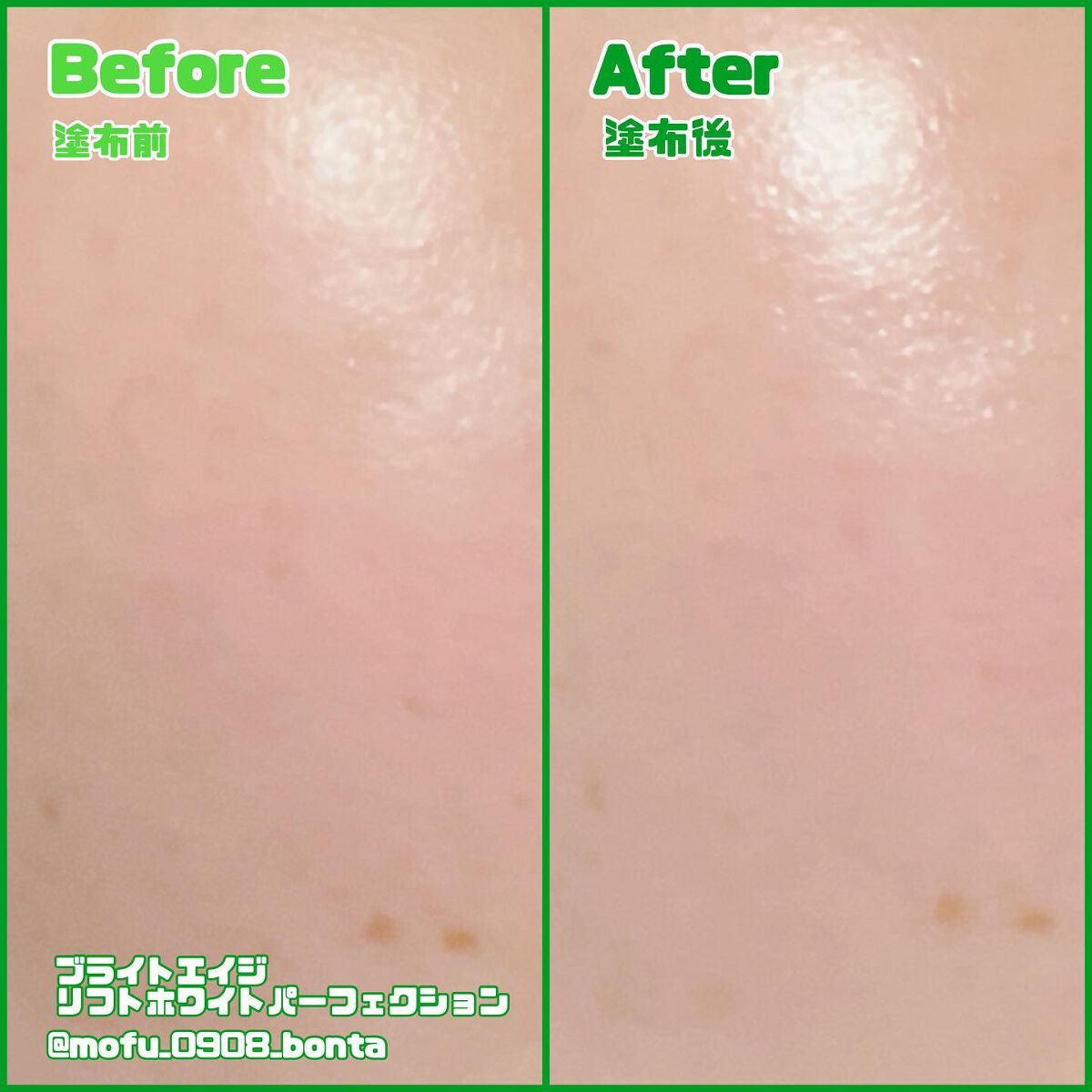 リフトホワイト パーフェクション/BRIGHTAGE/美容液を使ったクチコミ(5枚目)