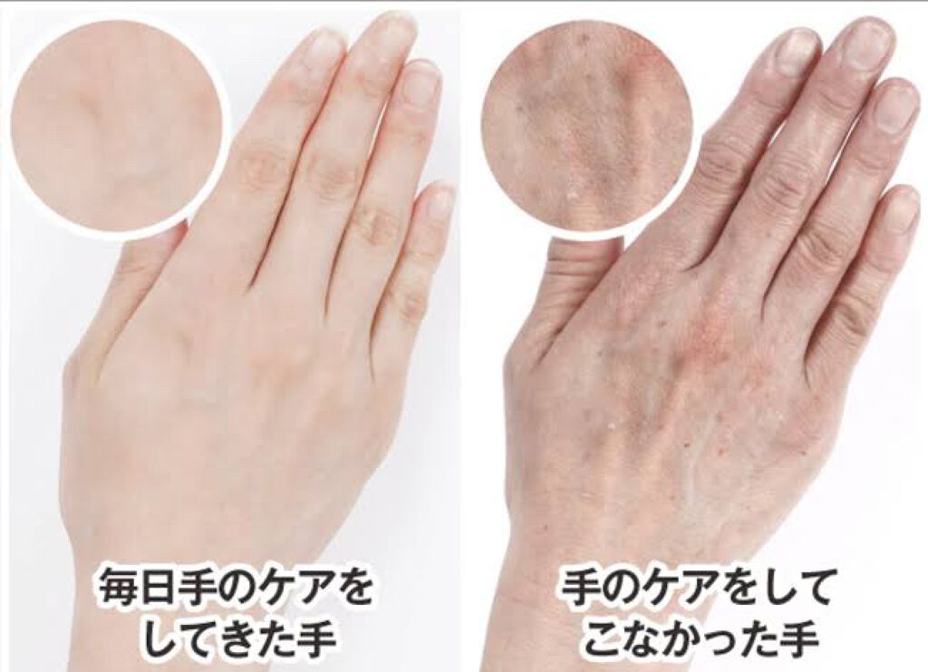 ナイトパック手袋/DAISO/ボディグッズを使ったクチコミ（2枚目）