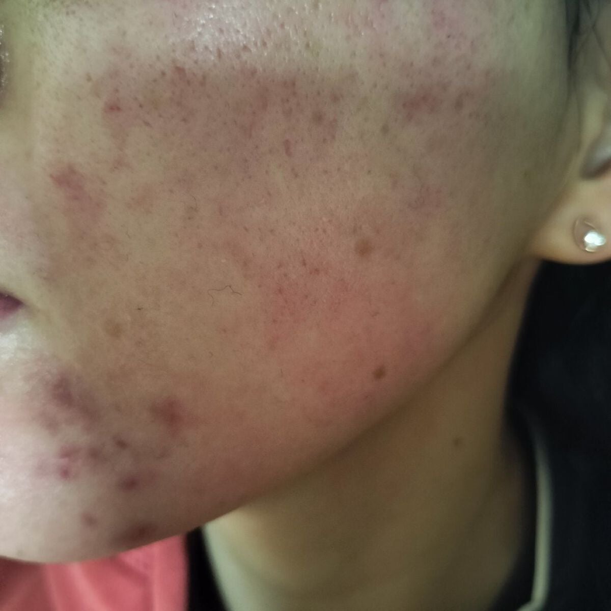 PLACENTREX EXTRACT GEL(ヒトプラセンタジェル)/Placentrex/その他を使ったクチコミ(3枚目)