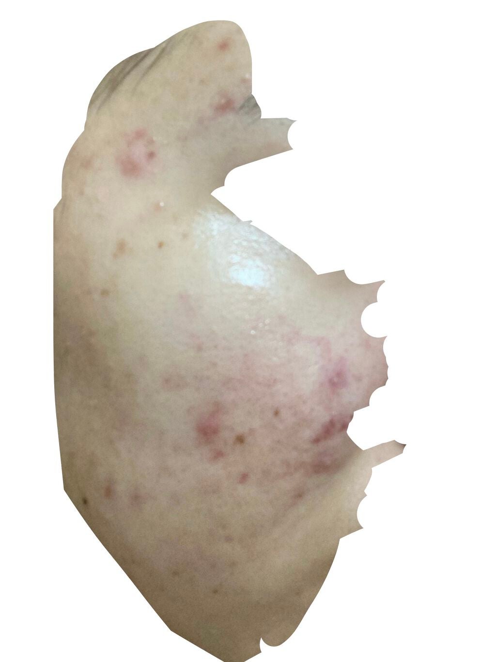 matsukiyo LAB 食べるサプリ マルチビタミン チュアブルタイプ/matsukiyo/健康サプリメントを使ったクチコミ(2枚目)