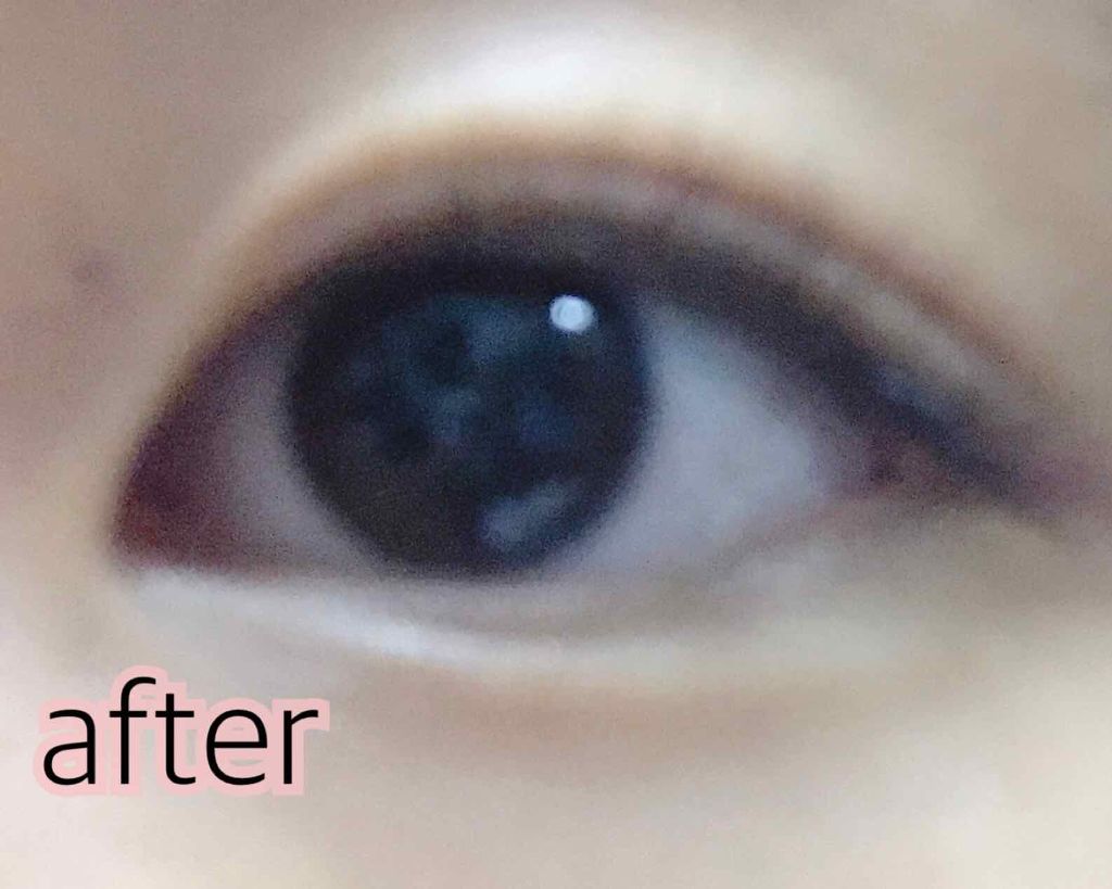 のびーるアイテープ(絆創膏タイプ、レギュラー)/DAISO/二重まぶた用アイテムを使ったクチコミ(3枚目)